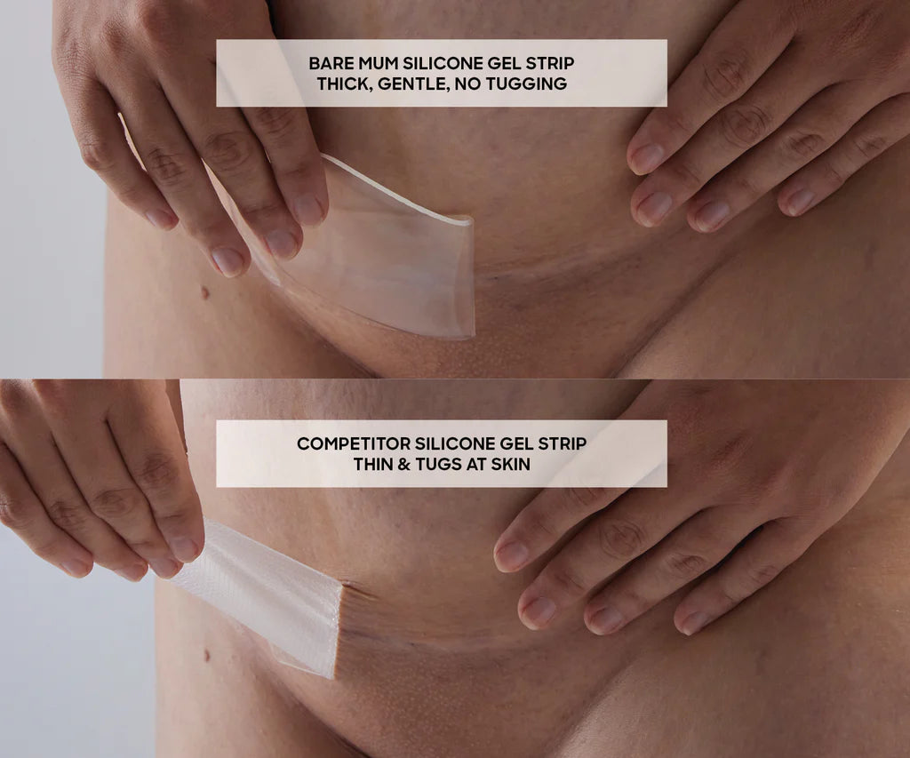 BARE MUM Silicone Gel Scar Strips